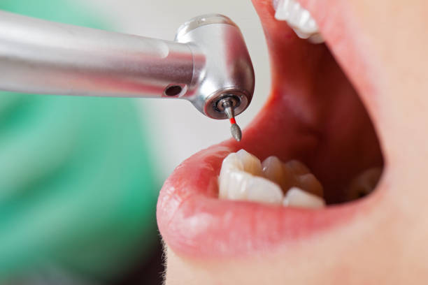 Best Emergency Dental Care for Trauma or Injury in Cade, LA